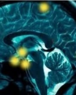 Bay Area Neuropsychology